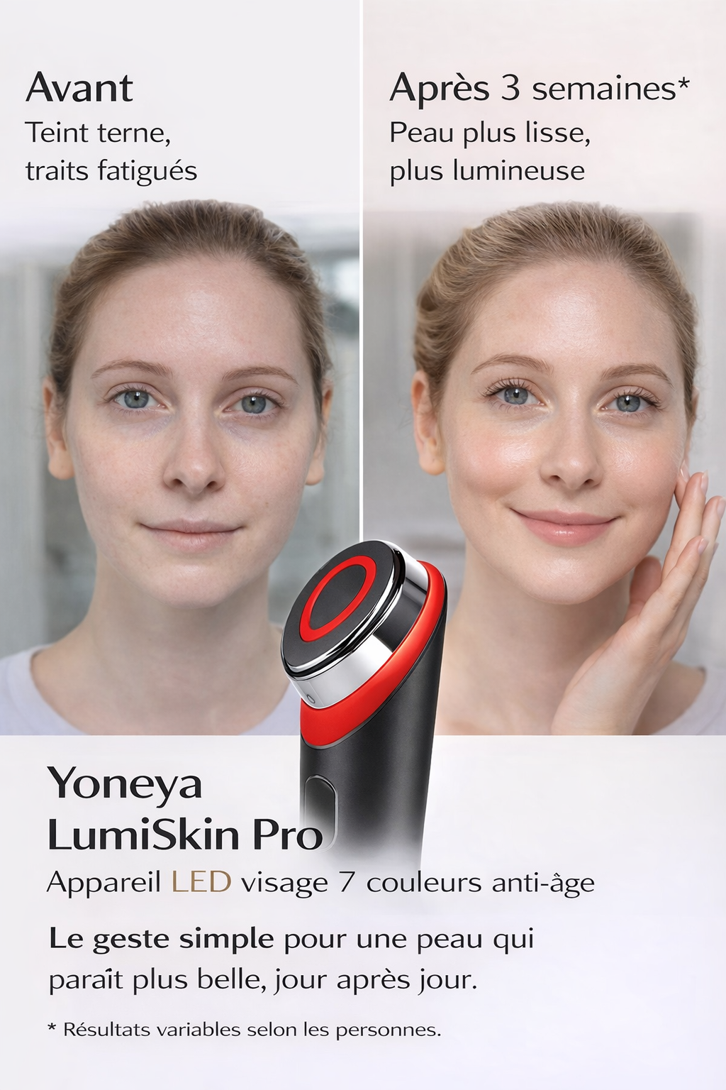 Résultats avant après appareil LED anti-âge visage Yoneya