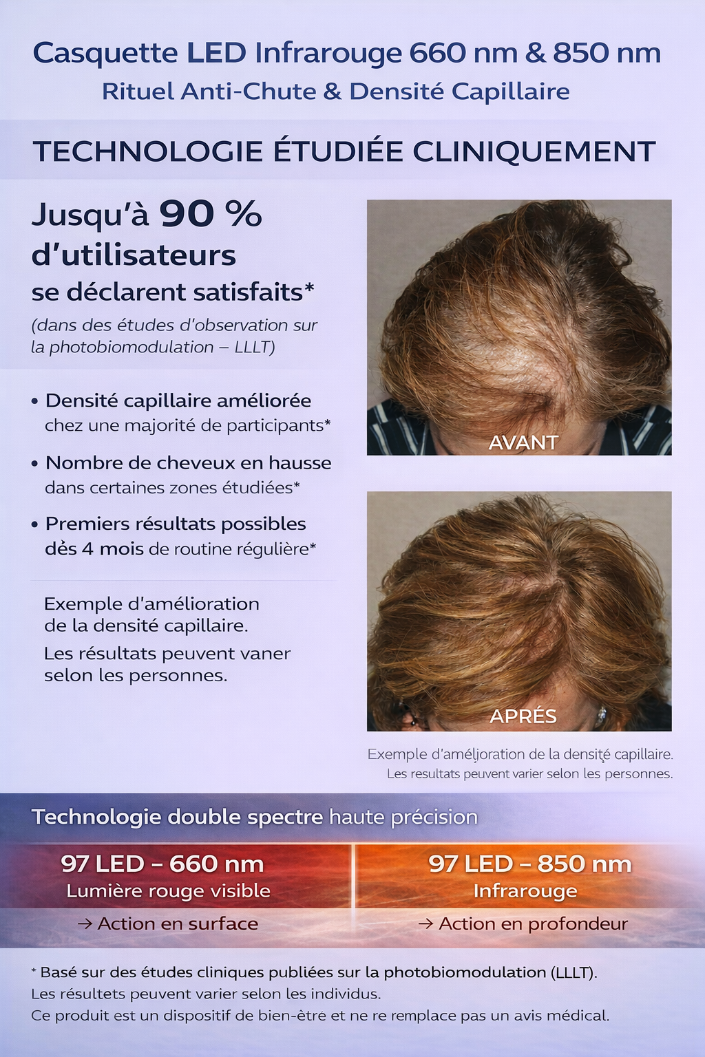 Casquette LED Infrarouge 660 nm & 850 nm – Rituel Anti‑Chute & Densité Capillaire