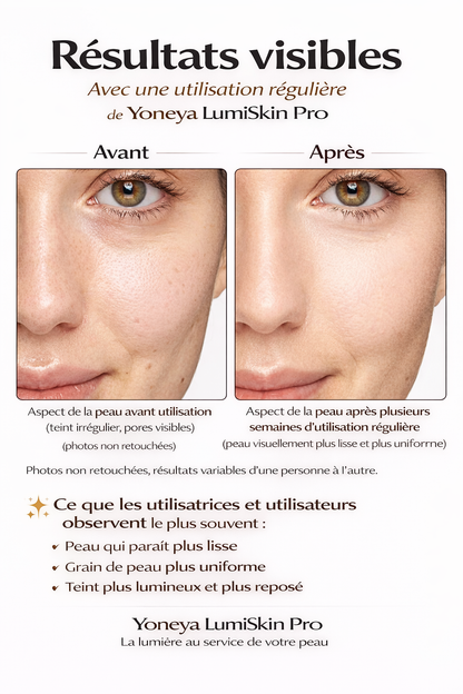 Appareil LED visage résultats visibles éclat et texture peau